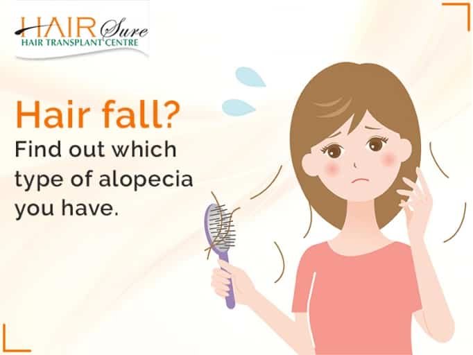 Alopecia Areata Causes Treatment And Symptoms Cyber Hairsure