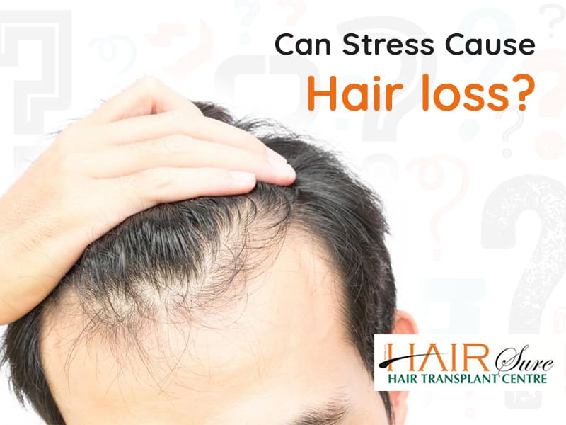 Can Stress Cause Hair Loss?
