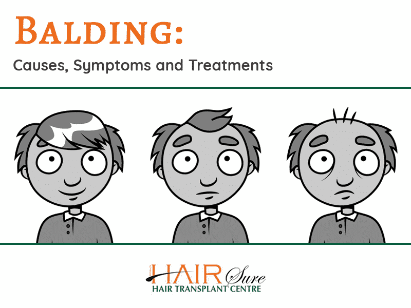 Balding: Causes, Symptoms and Treatments