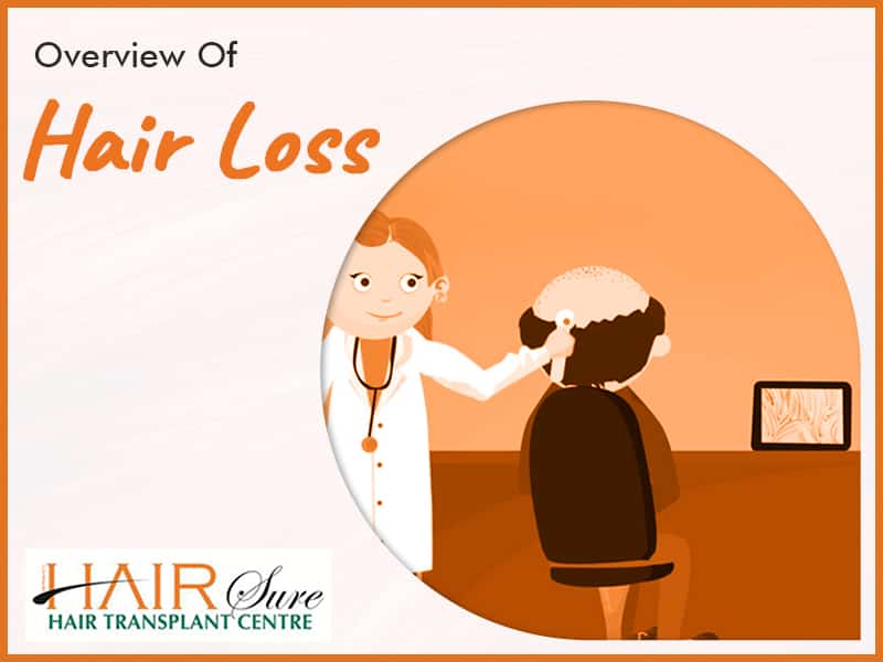 Overview Of Hair Loss
