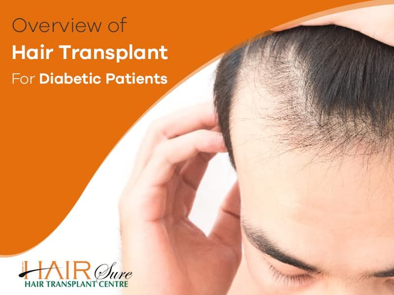 Hair Transplant Procedures for Diabetic Patients at Best Hair Transplant, One of the best Hair Restoration Centres in Hyderabad