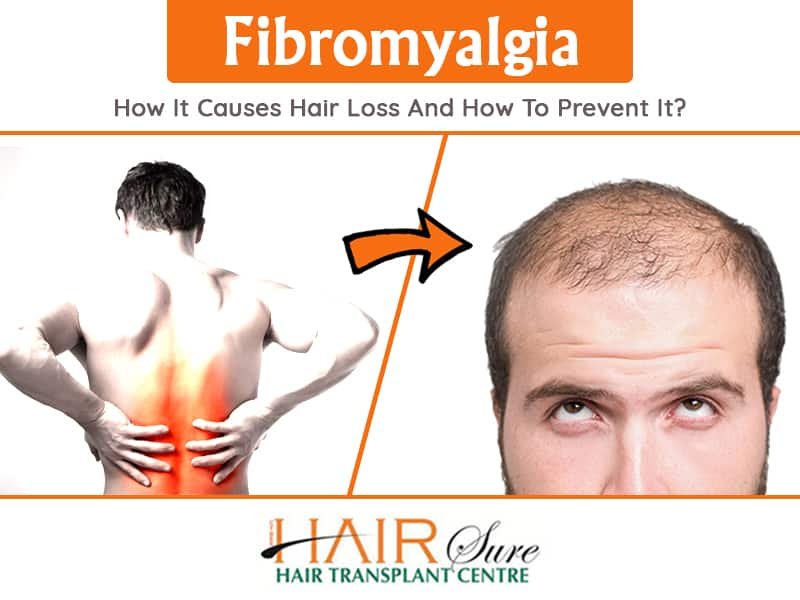 Fibromyalgia hair loss treatment in Hyderabad, hair transplant surgery Specialists near me
