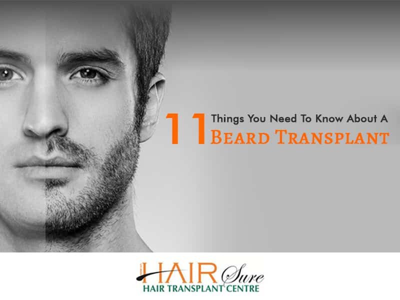 Top 11 Important Facts You Should Know About Hair Transplant by Dr V. Shashikanth, One of the best Hair Restoration treatment Doctors in Hyderabad