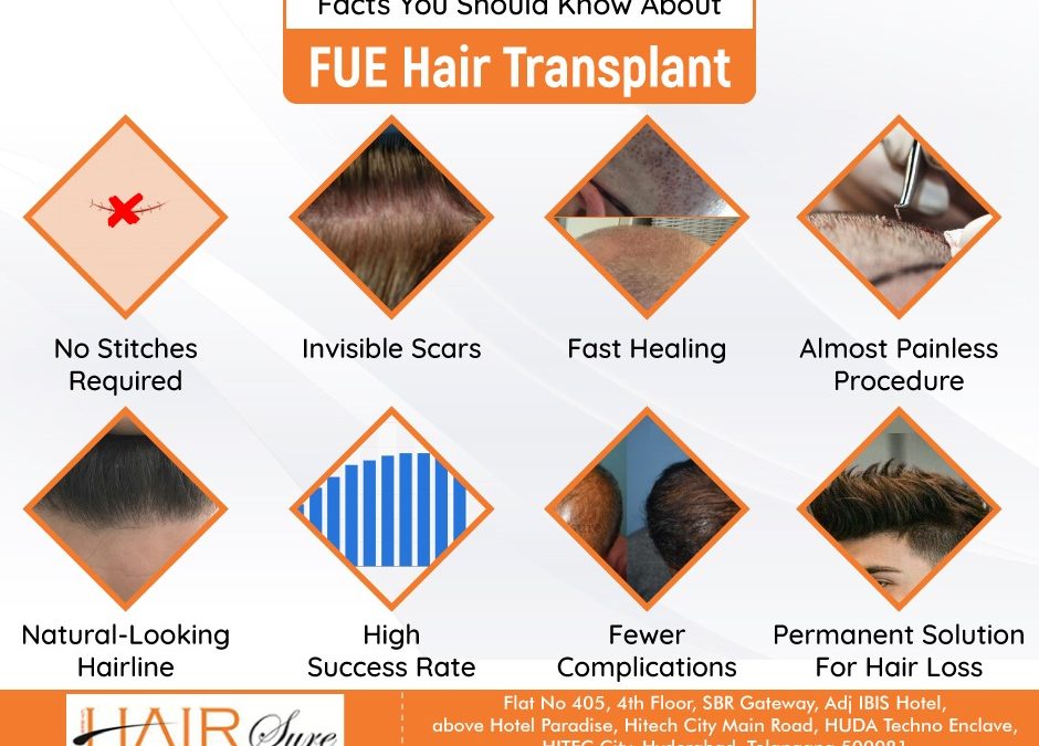 Facts You Should Know About FUE Hair Transplant