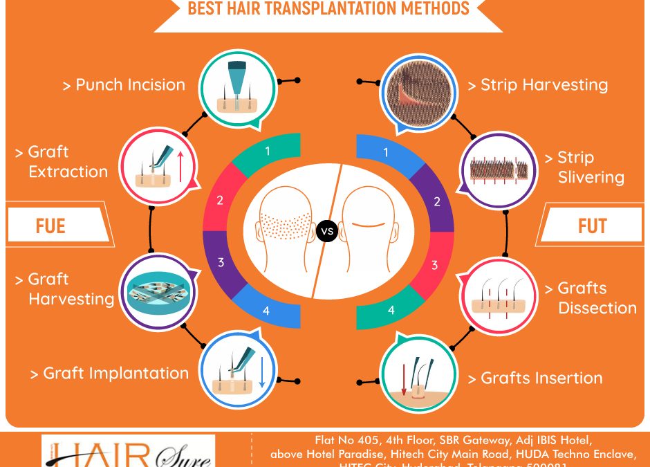 The Best Techniques Of Hair Transplantation For Males