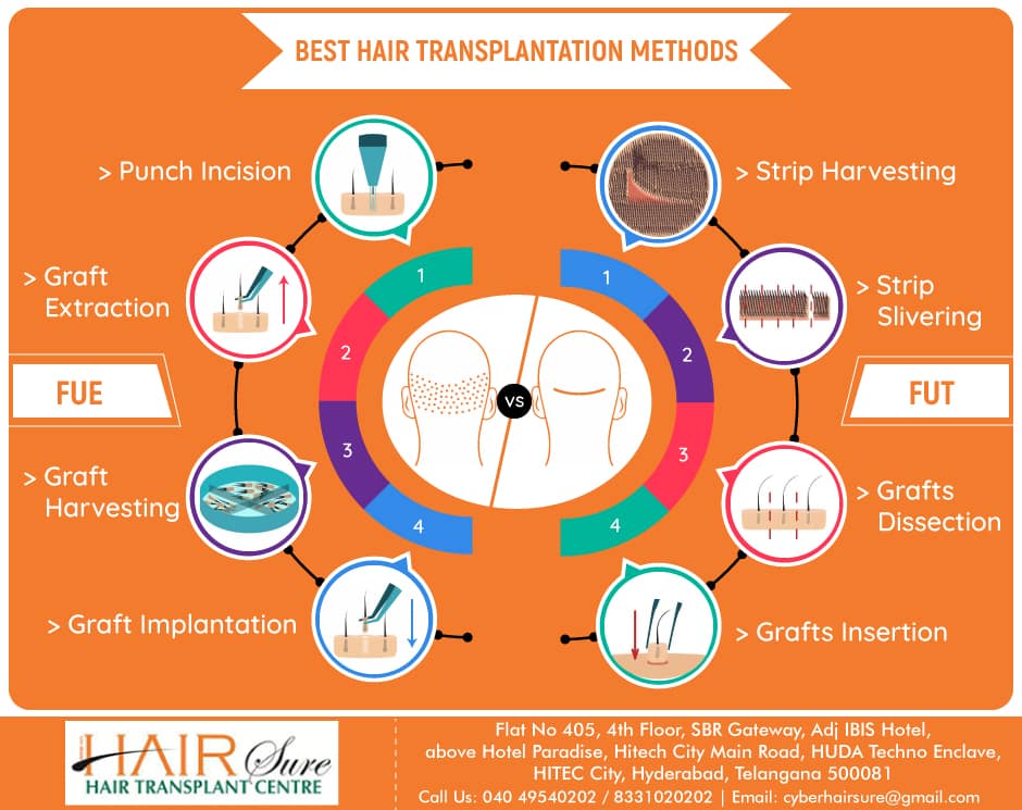All types of hair transplant techniques at Best Hair Transplant, One of the best Clinics for hair Restoration in Hyderabad