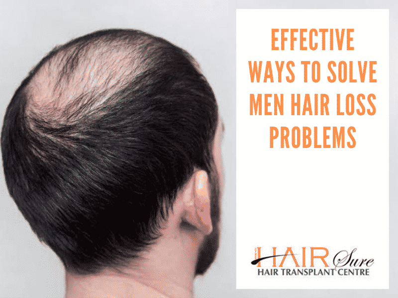 Best Effective Ways to Stop Hair Loss in Men at Best Hair Transplant, One of the best Hair Restoration Centres in Hyderabad