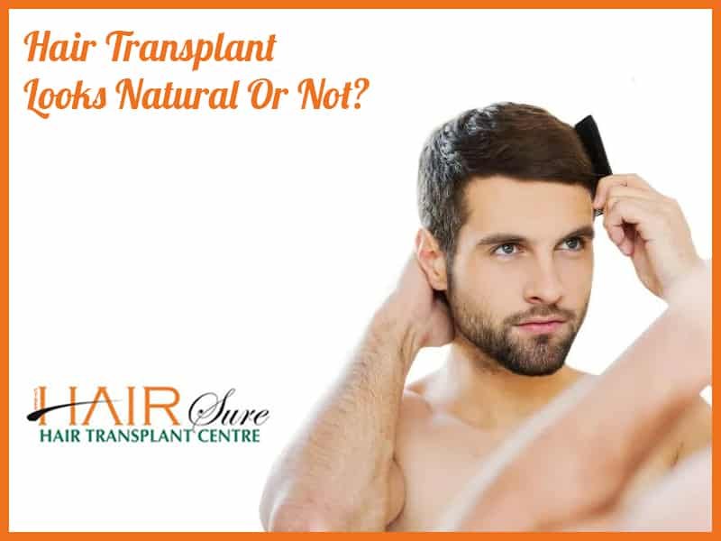 Natural-looking hair transplantation surgery at Best Hair Transplant, One of the best hair restoration Hospitals in Hyderabad