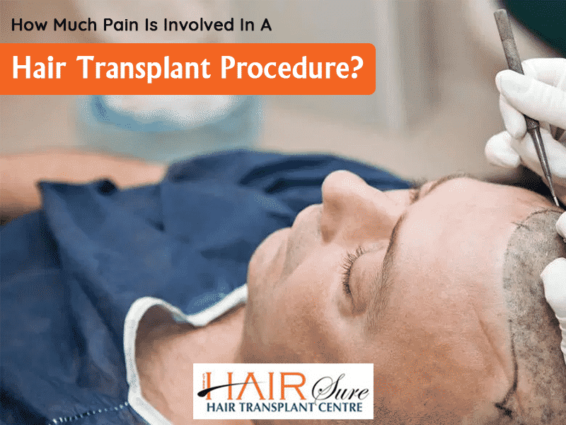 Best Hair transplant treatment procedure by Dr Shashikanth, One of the best Hair Transplant Surgeons in Hyderabad