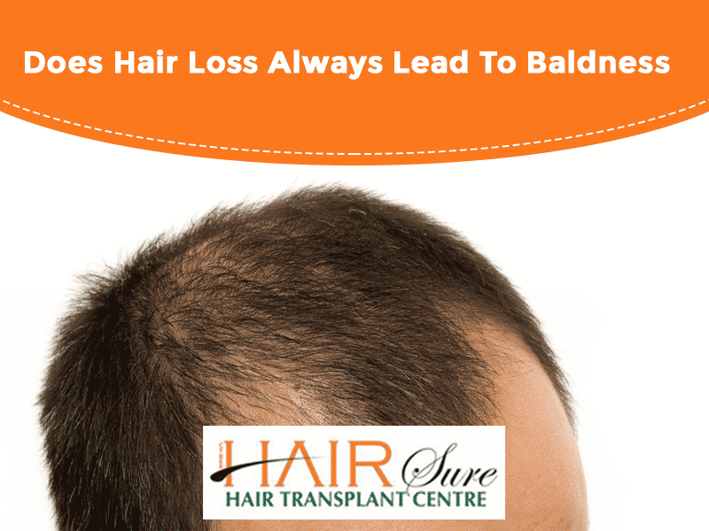 Contact Dr Ravi Chander Rao for male Pattern Baldness treatment, One of the best hair transplant Surgeons in Hyderabad