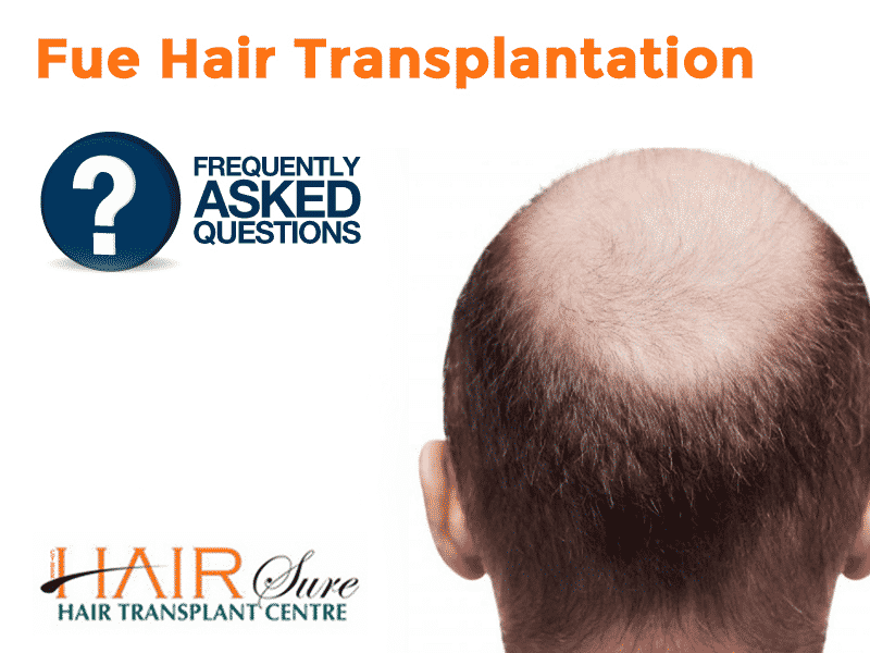 Fue Hair Transplantation – Frequently Asked Questions