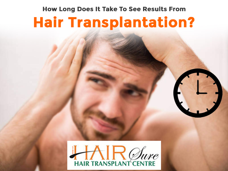 Know your Hair Transplant Results Timeline By Dr Sridhar Reddy, One of the best Hair loss treatment Specialists in Hyderabad