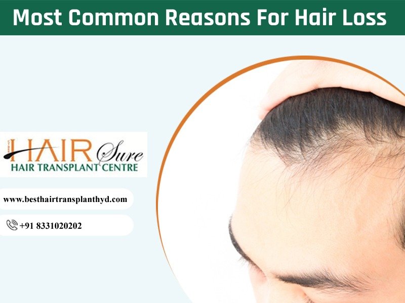 Most Common Reasons For Hair Loss
