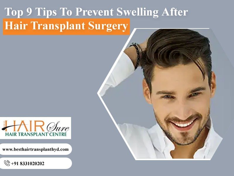 Top 9 Tips To Prevent Swelling After Hair Transplant Surgery Cyber