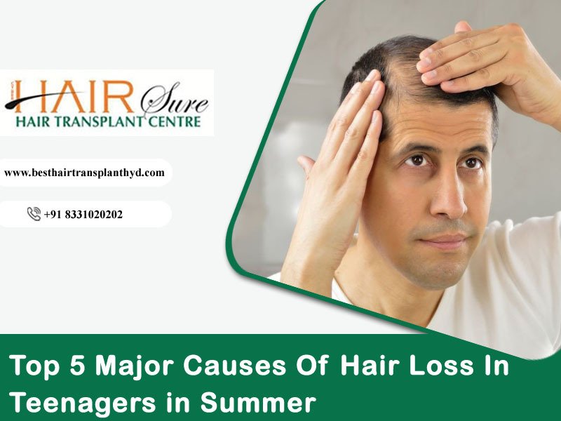 Contact Hair Sure clinic to know the causes of hair loss in teenage males, best hair fall treatment hospital in Hyderabad