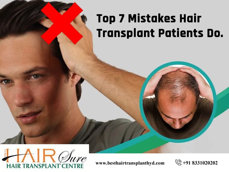 Top 7 Mistakes Hair Transplant Patients Do