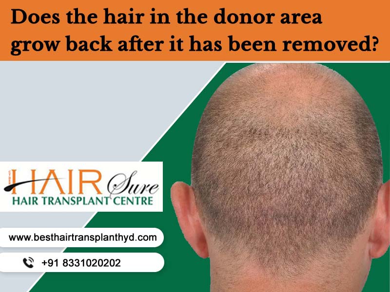 Does the hair in the donor area grow back after it has been removed?