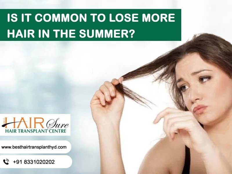 Is It Common To Lose More Hair In The Summer