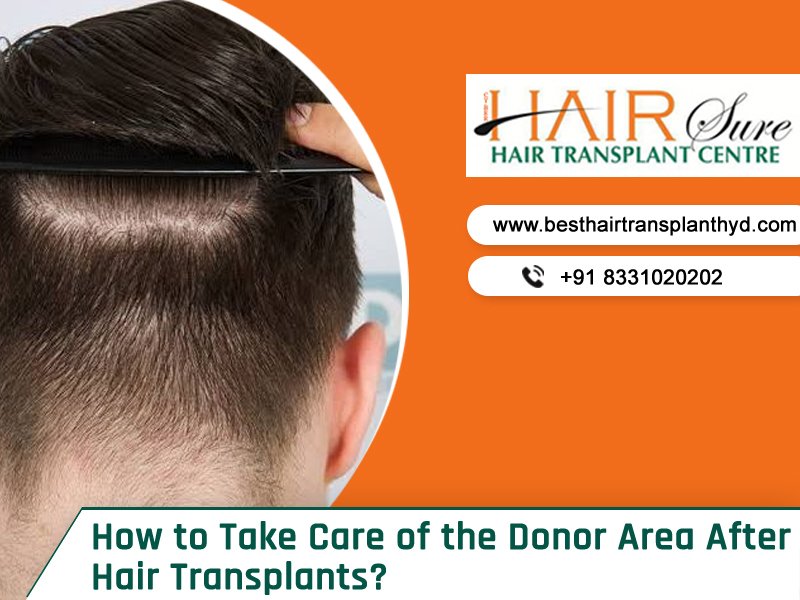Consult Best Hair Transplant Doctor for hair transplant donor area recovery tips, hair transplant surgeons near me