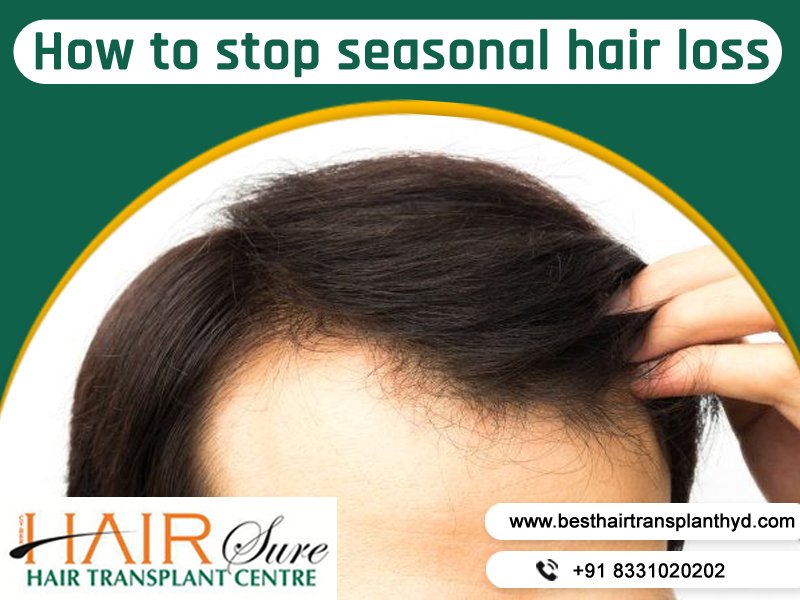 Tips to prevent hair fall in changing season at Best Hair Transplant, FUT hair transplant near Kothapet