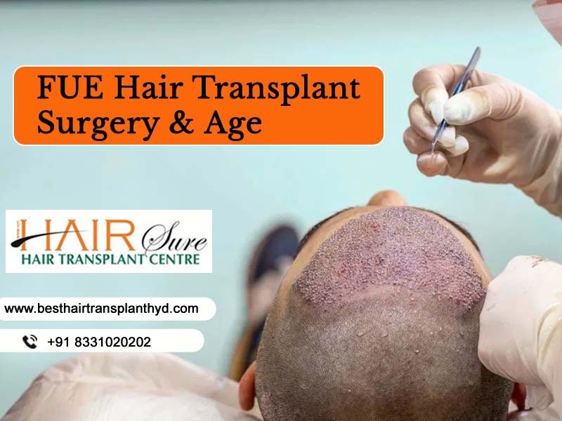 FUE hair transplant hospital in Hyderabad, fue hair transplant near Kondapur