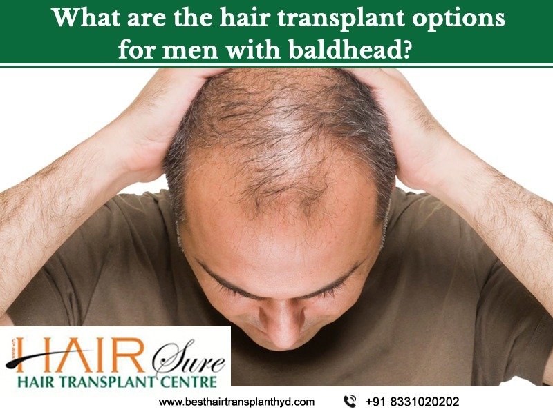 Get best Hair Transplant at Cyber Hair Sure, hair transplant specialist near Hitech city