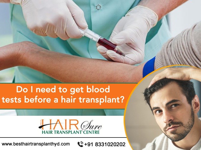 Best Clinic for Hair Transplantation in Hyderabad, best hair transplant doctors near Kothaguda