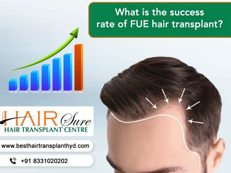 Get the best method for Sapphire hair transplant in Hyderabad, hair specialist in Hyderabad