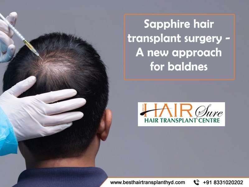 Best sapphire Hair Transplant Surgery in Hyderabad,Best Hair Transplant Clinic near me