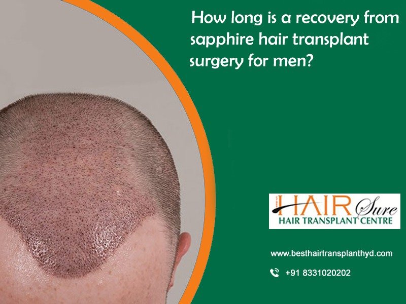 Best sapphire Hair Transplant Surgery in Hyderabad, Hair Transplant hospital in Hyderabad