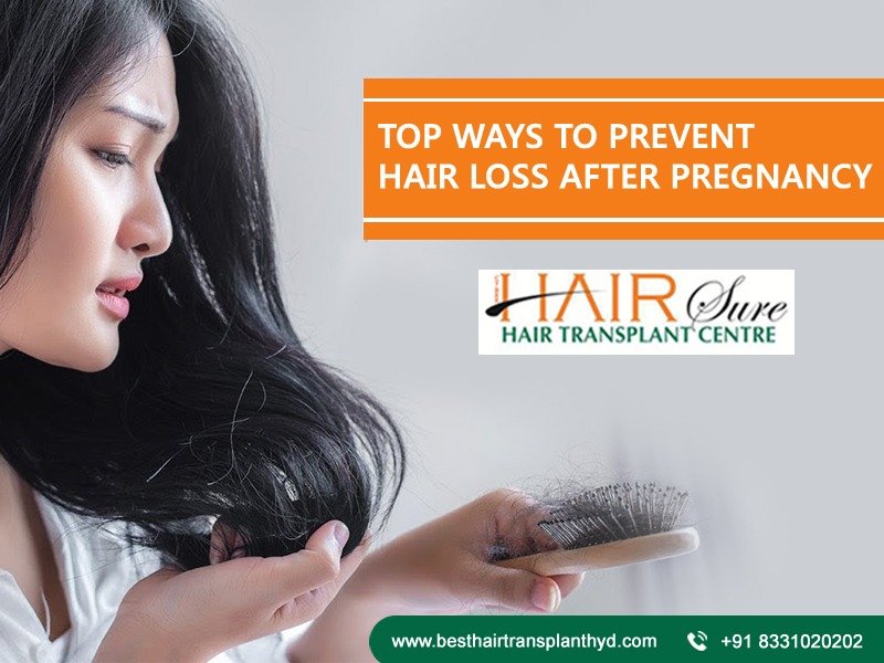 Best Healthy Hair loss treatment by Hairsure clinic, One of the Best Female Hair loss treatment in Hyderabad