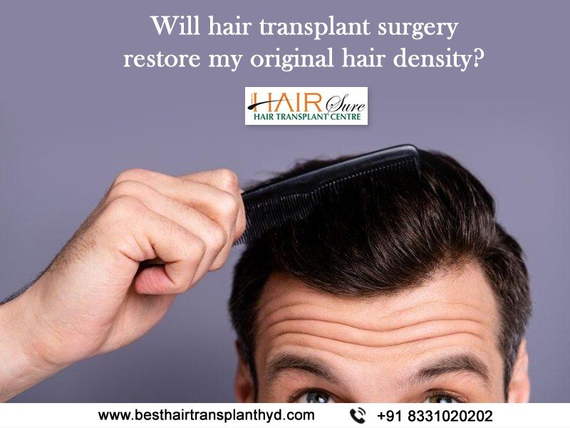 Will Hair Transplant Surgery Restore My Original Hair Density
