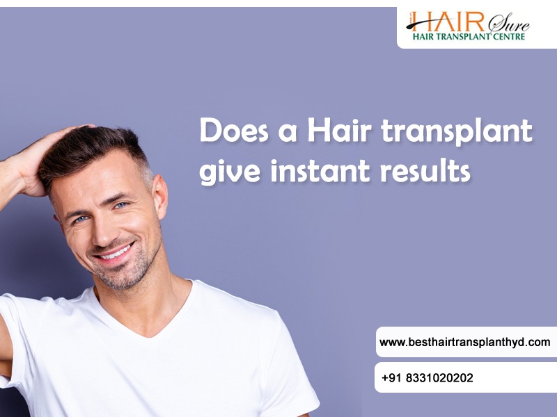 Does a hair transplant give instant results?