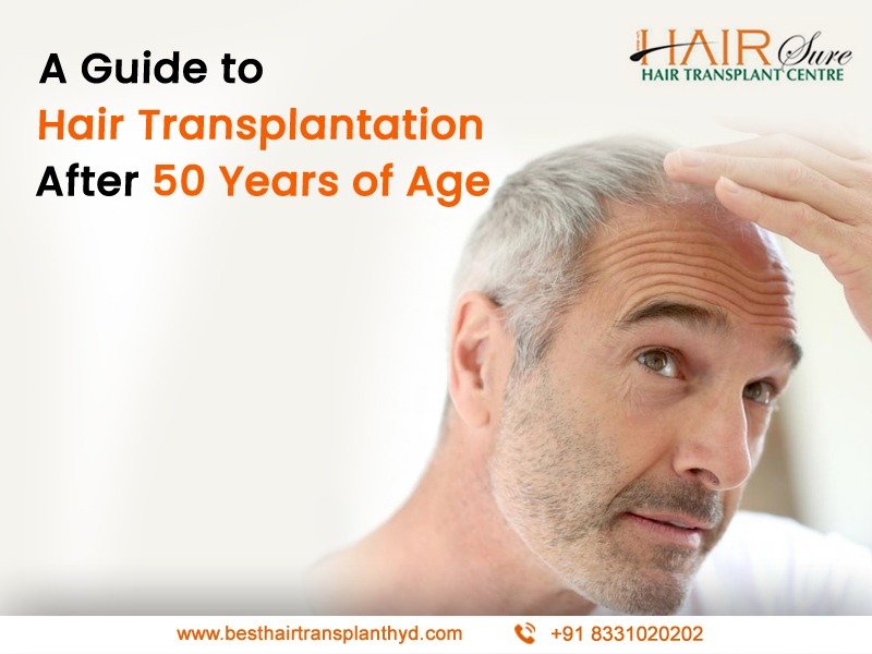 A Guide To Hair Transplantation After 50 Years Of Age Cyber Hairsure