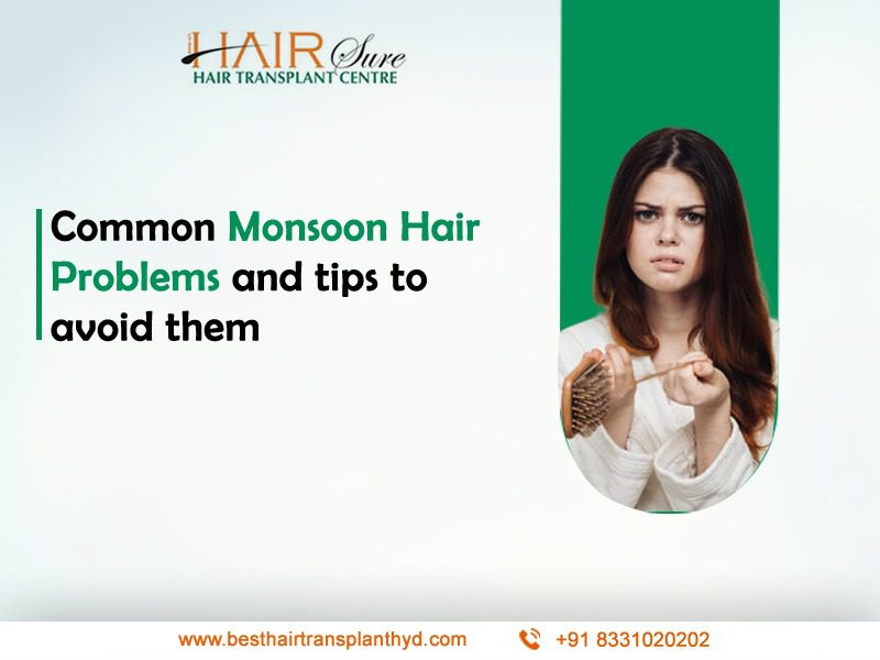 5 Common Monsoon Hair Problems and tips to avoid them