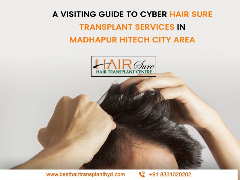 A visiting guide to cyber hair sure transplant services in Madhapur Hitech city area