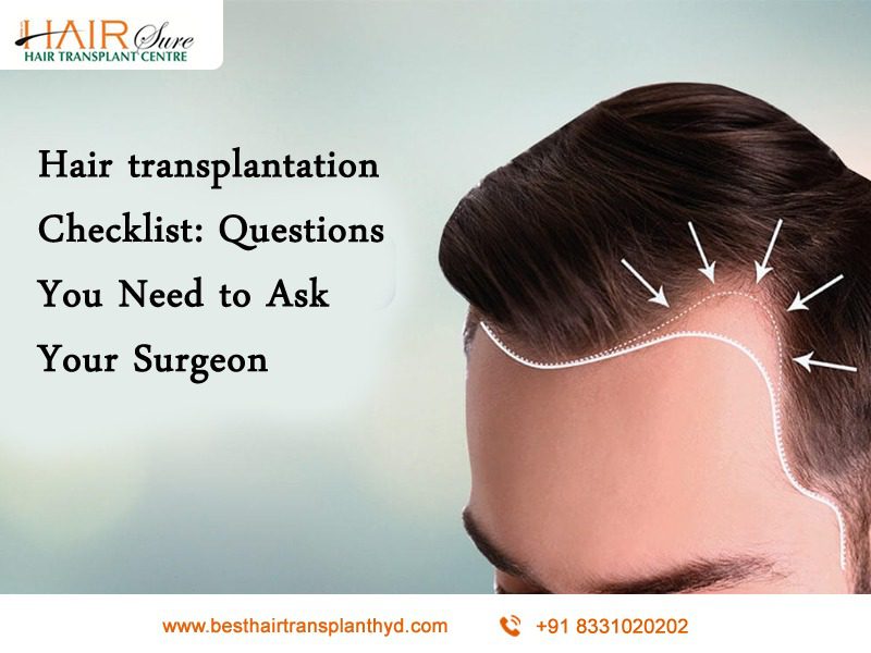Hair transplantation Checklist: Questions You Need to Ask Your Surgeon