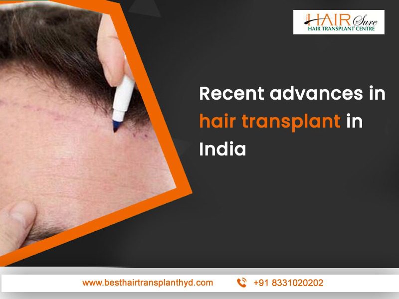Recent advances in hair transplant in India