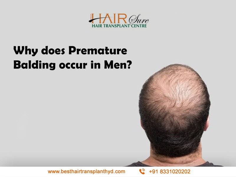 Consult for Hair transplantation at best hair transplant clinic, hair transplant clinic in Hyderabad