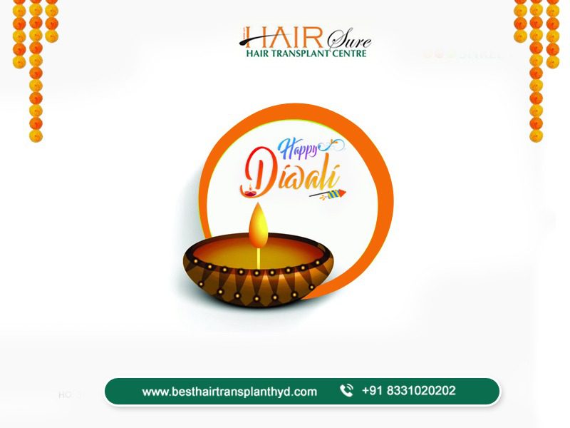 Wish you all Happy and safe Diwali –  Cyber Hair Sure