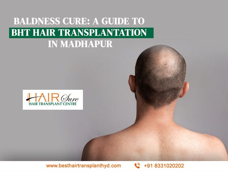 Baldness Cure: A Guide to BHT Hair transplantation in Madhapur