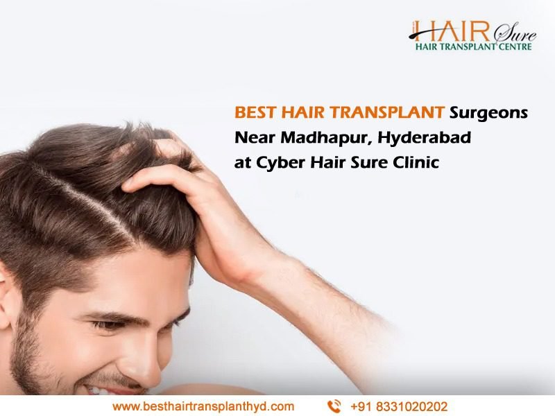 Best Healthy Hair loss treatment by Best hair transplant Surgeon, One of the Best Female Hair loss treatment in Madhapur, Hyderabad.