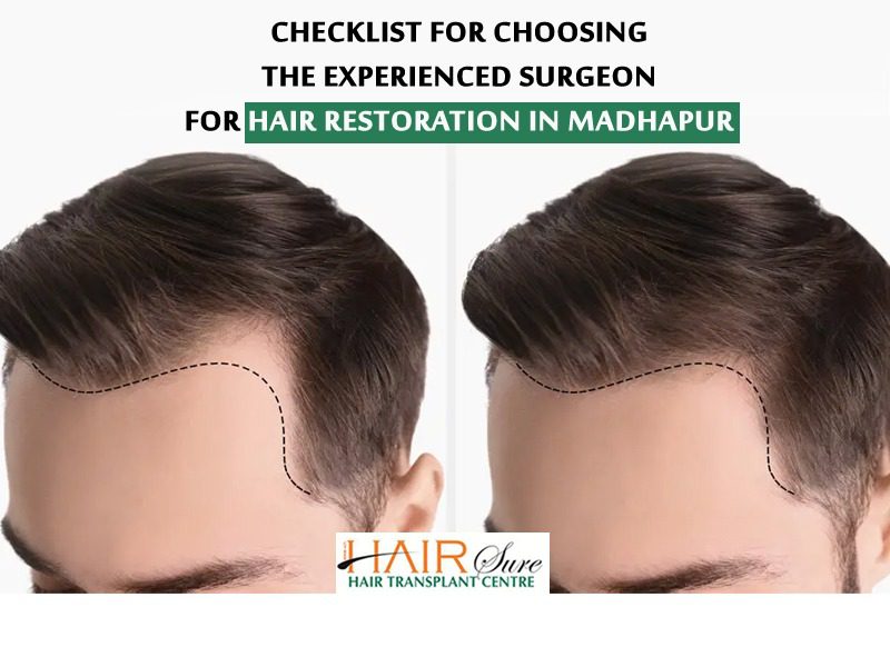 Checklist for choosing the experienced surgeon for hair restoration in Madhapur