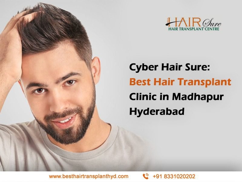 Best Healthy Hair loss treatment by Best hair transplant Surgeon, One of the Best Female Hair loss treatment in Madhapur, Hyderabad.