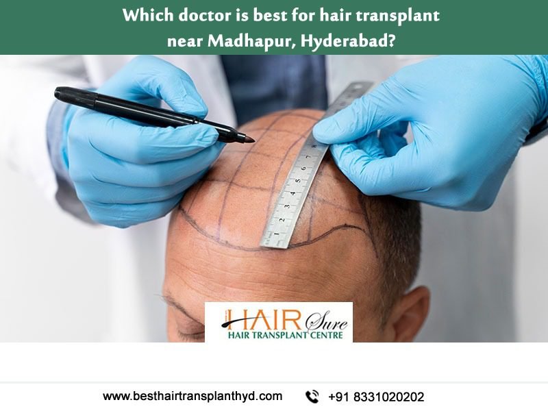 Which Doctor Is Best For Hair Transplant Near Madhapur, Hyderabad