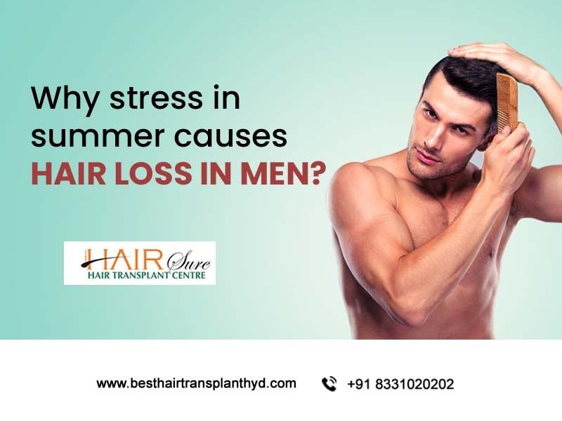 Why Stress In Summer Causes Hair Loss In Men