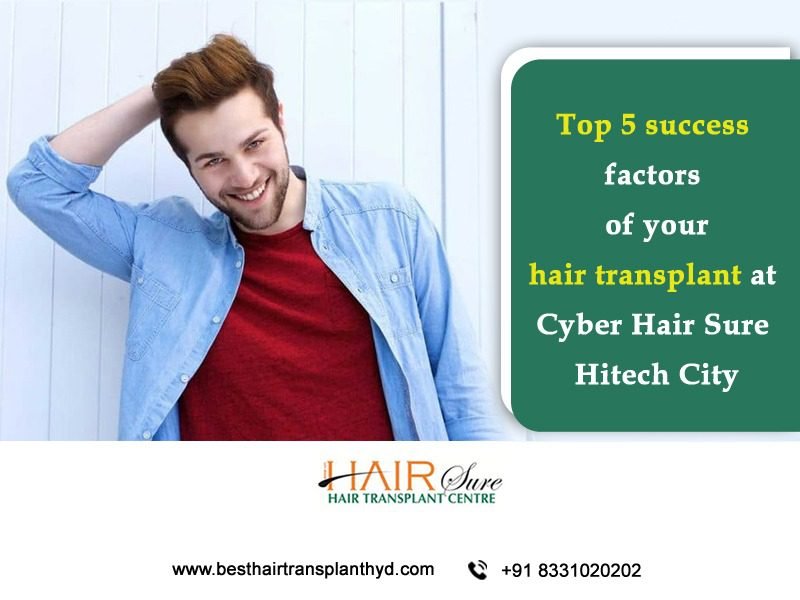 Top 5 Success Factors Of Your Hair Transplant At Cyber Hair Sure Hitech City