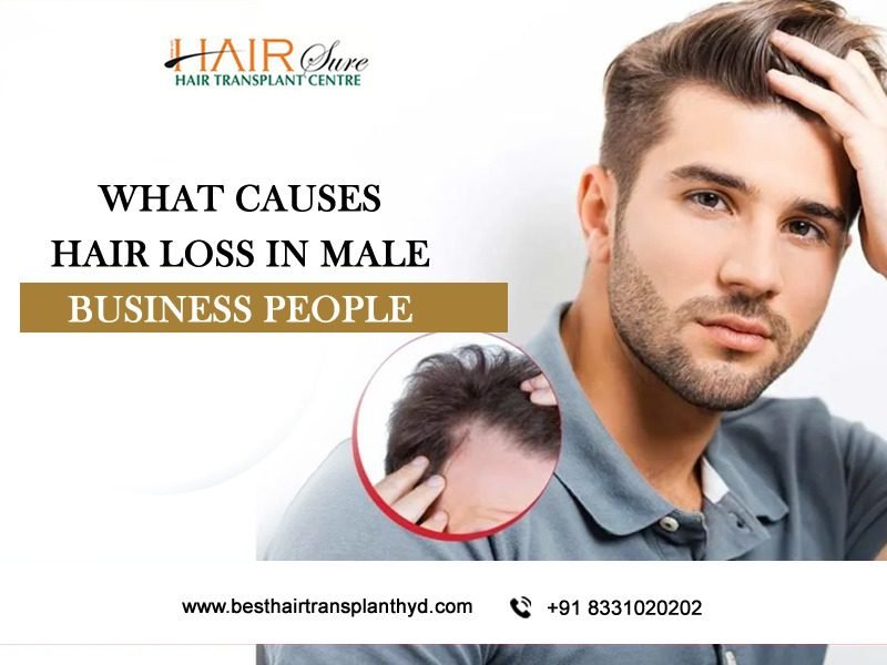 What Causes Hair Loss In Male Business People